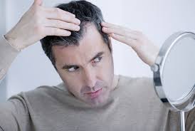 How to Prevent Hair Loss in Men: Causes, Myths, and Science-Backed Methods